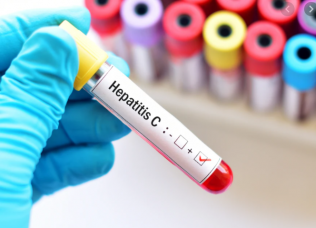 Комбинация Софосбувир и Велпатасвир, чтобы увидеть лучшие результаты.