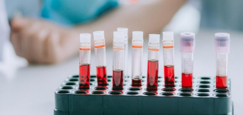 Анализ на ВИЧ и гепатит